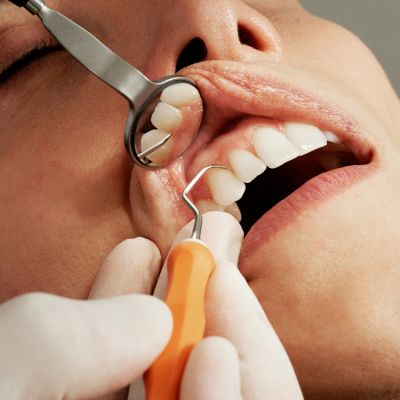 Identify Signs and Symptoms of Root Canal
